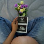 Women with polycystic ovary syndrome exhibit impaired endometrial receptivity with excessive ER and histone lactylation