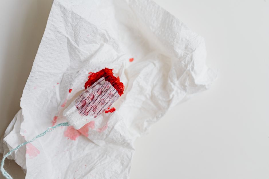 Period poverty: A global menstrual health crisis