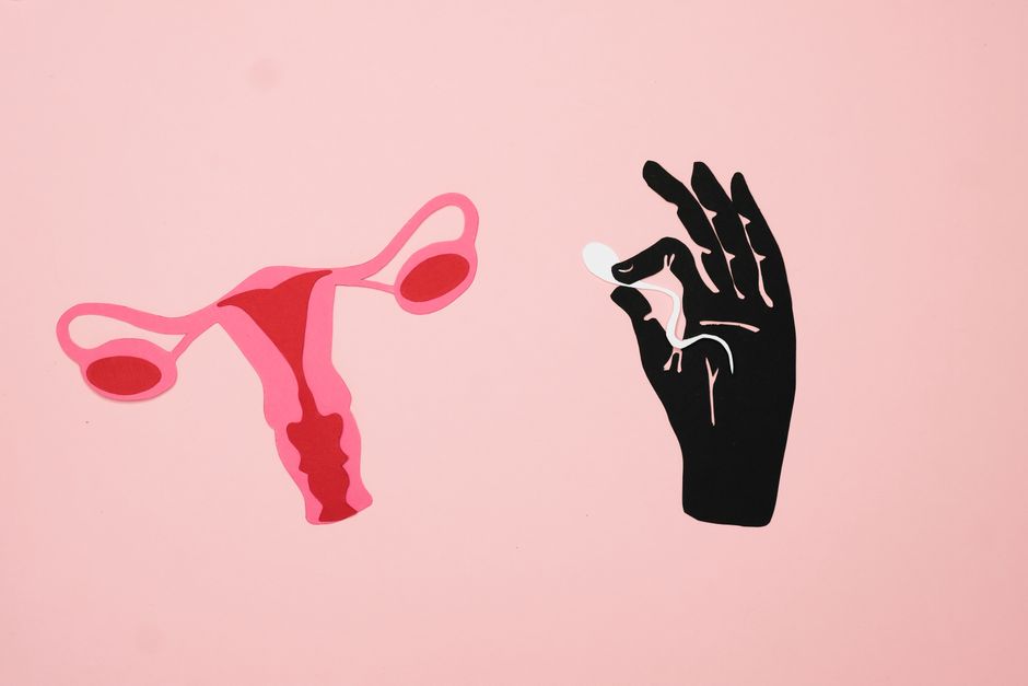 Women with polycystic ovary syndrome exhibit impaired endometrial receptivity with excessive ER and histone lactylation