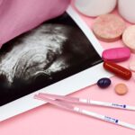 Women with polycystic ovary syndrome exhibit impaired endometrial receptivity with excessive ER and histone lactylation