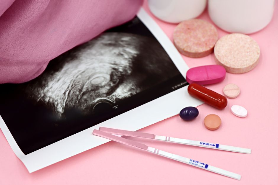 Women with polycystic ovary syndrome exhibit impaired endometrial receptivity with excessive ER and histone lactylation