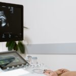 Women with polycystic ovary syndrome exhibit impaired endometrial receptivity with excessive ER and histone lactylation