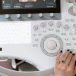 Women with polycystic ovary syndrome exhibit impaired endometrial receptivity with excessive ER and histone lactylation