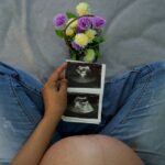 Women with polycystic ovary syndrome exhibit impaired endometrial receptivity with excessive ER and histone lactylation
