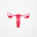 Women with polycystic ovary syndrome exhibit impaired endometrial receptivity with excessive ER and histone lactylation