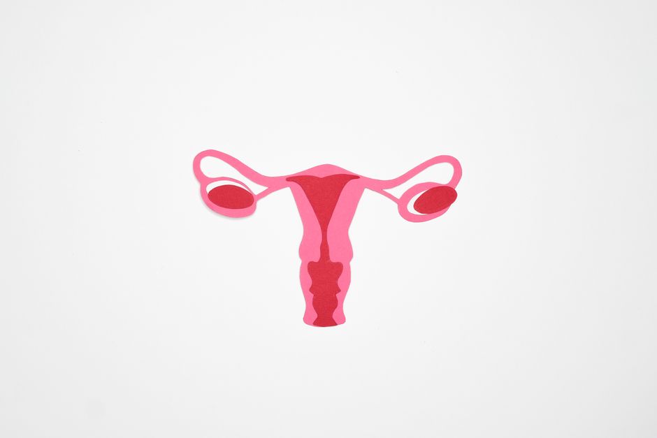 Women with polycystic ovary syndrome exhibit impaired endometrial receptivity with excessive ER and histone lactylation