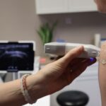 Assessment of perineal body properties in women with stress urinary incontinence using Transperineal shear wave elastography