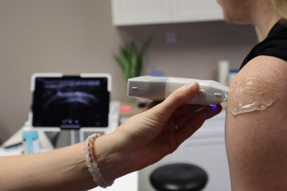 Assessment of perineal body properties in women with stress urinary incontinence using Transperineal shear wave elastography