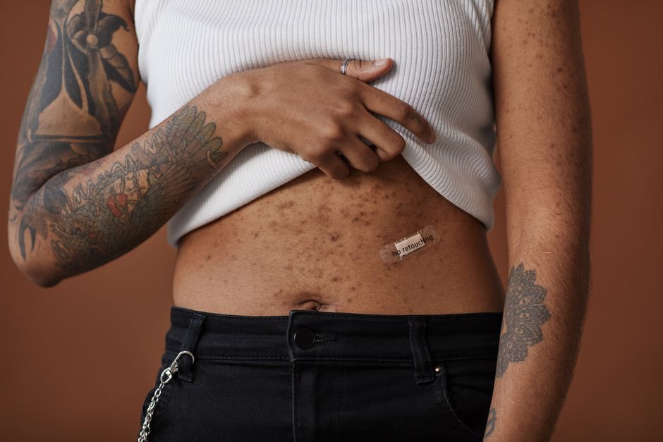 Woman suffers permanent brain damage after 15-day water-only fast loses 20kg